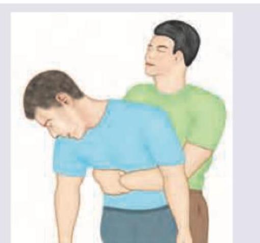 Image for question 742