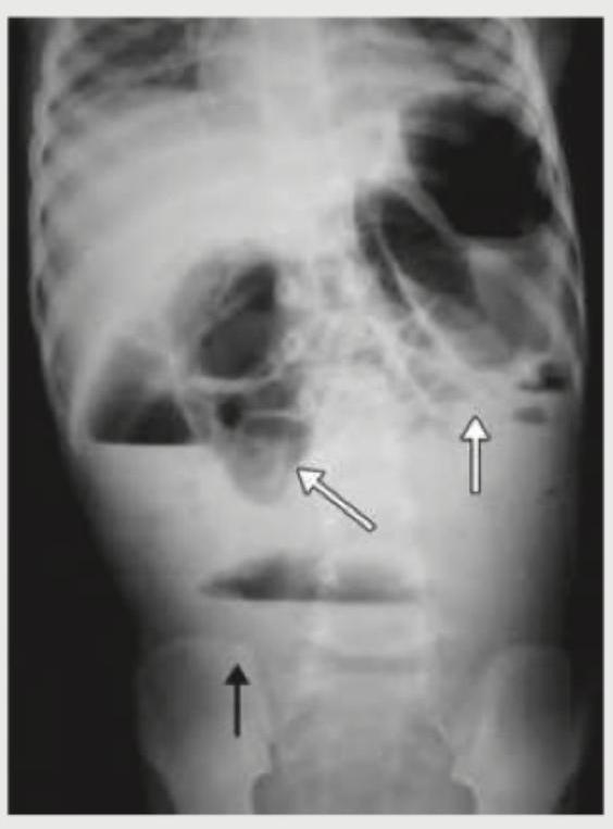 Image for question 138