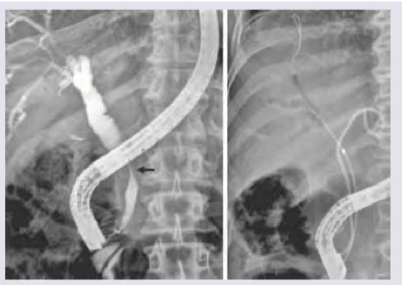 Image for question 492