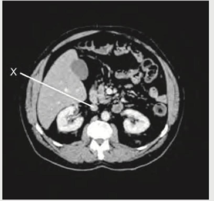 Image for question 143
