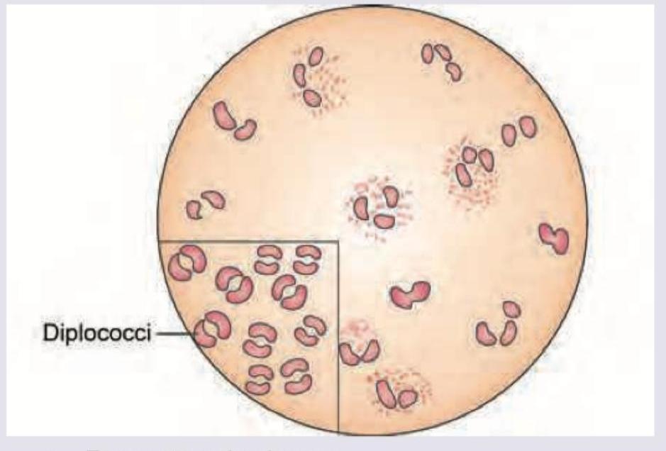 Image for question 2066