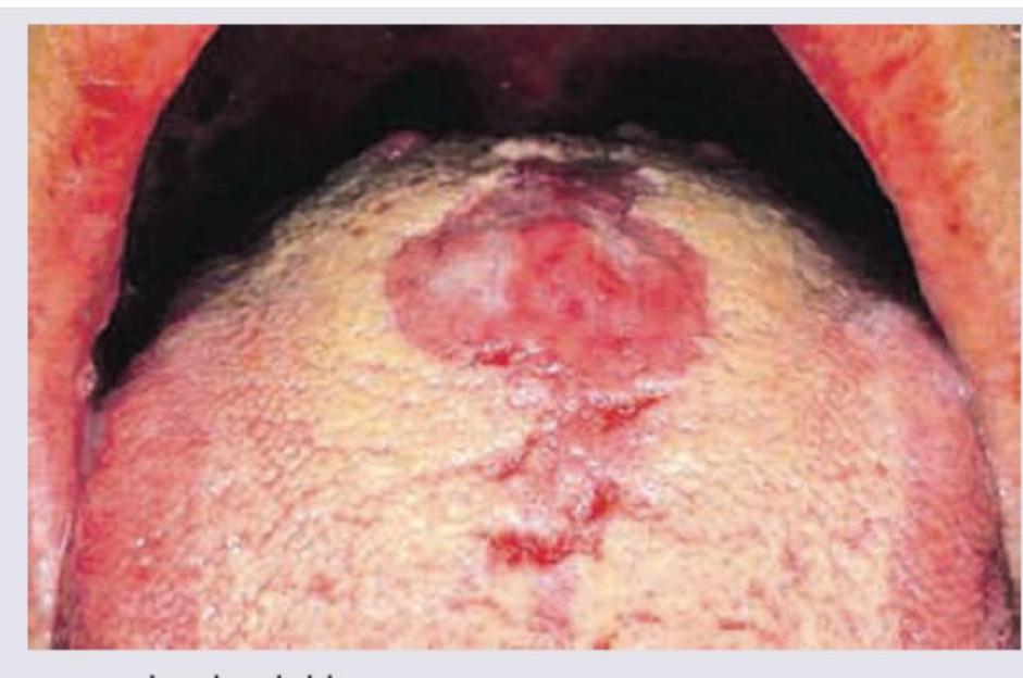 Image for question 73