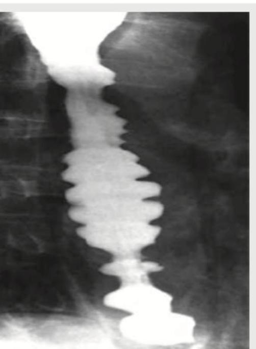 Image for question 176