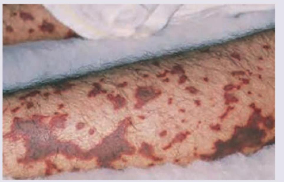 Image for question 96