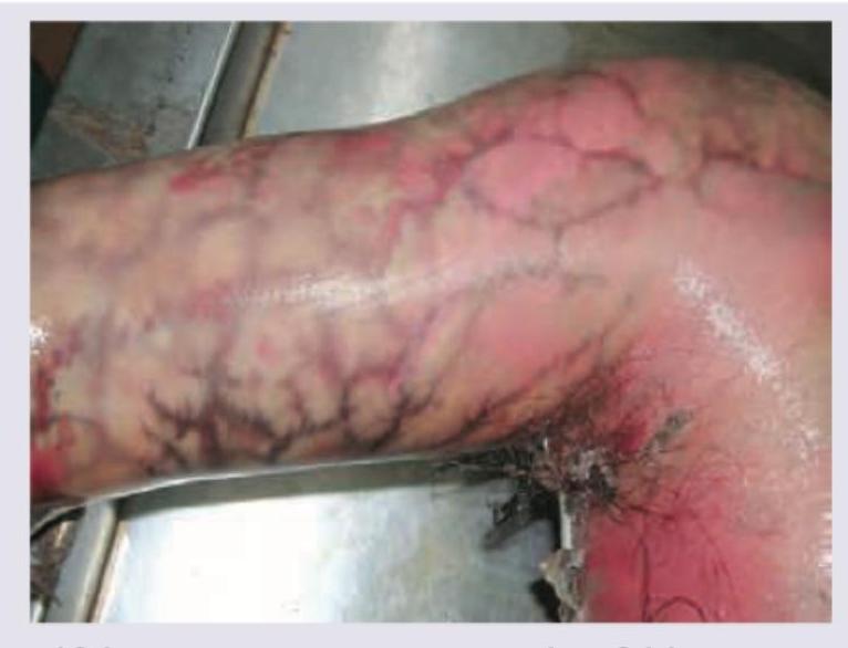 Image for question 130