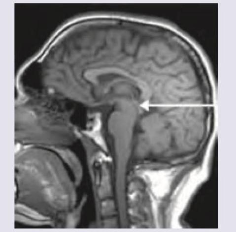 Image for question 55