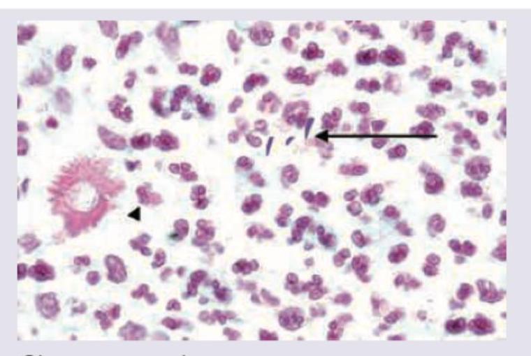 Image for question 104