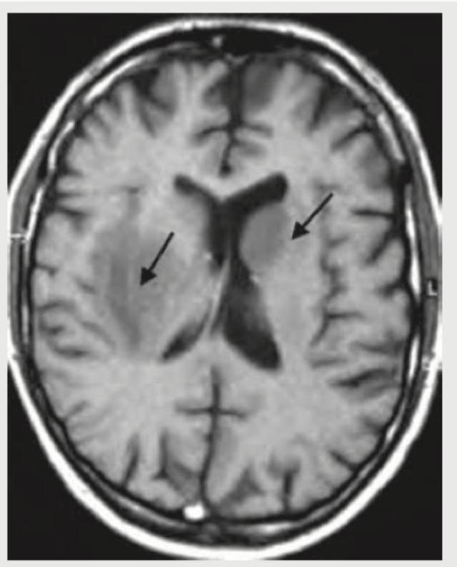 Image for question 355