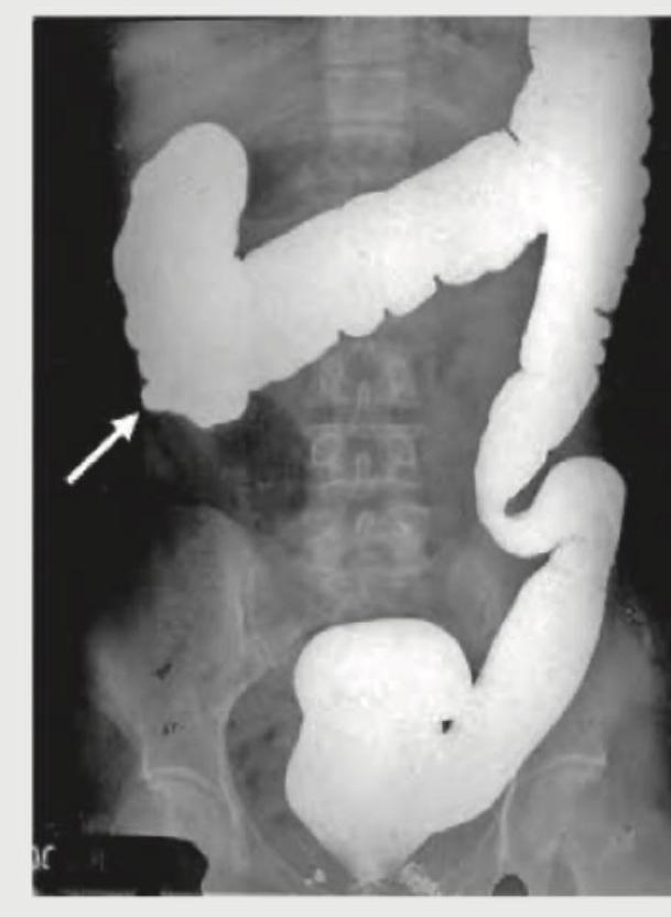 Image for question 550