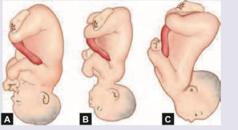 Image for question 848