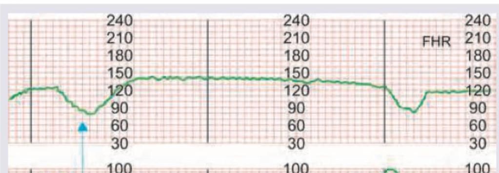 Image for question 842