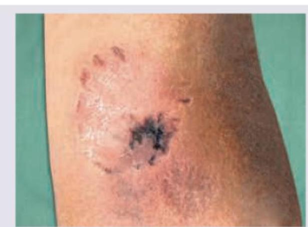 Image for question 493