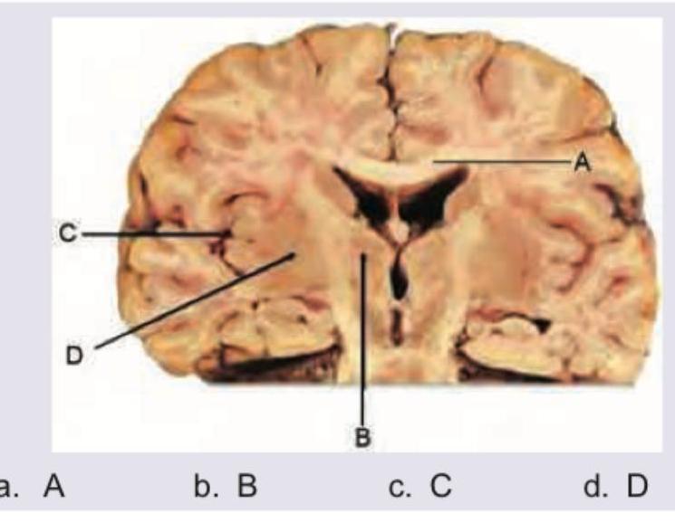 Image for question 359