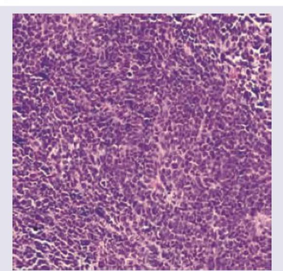 Image for question 413