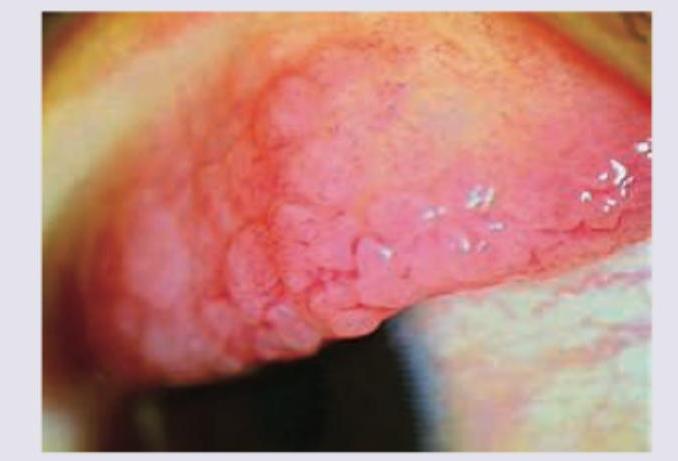 Image for question 263