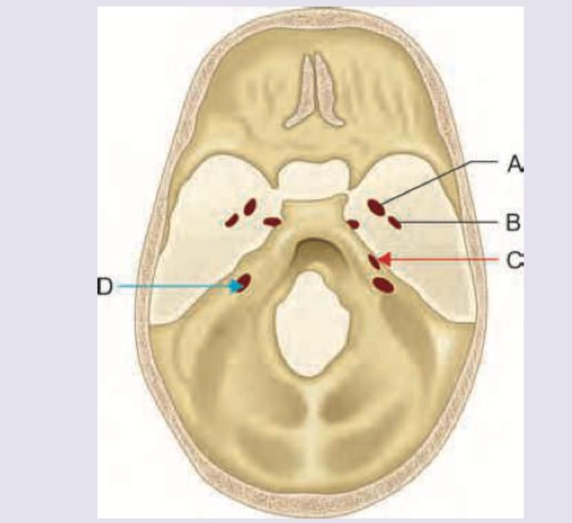 Image for question 10