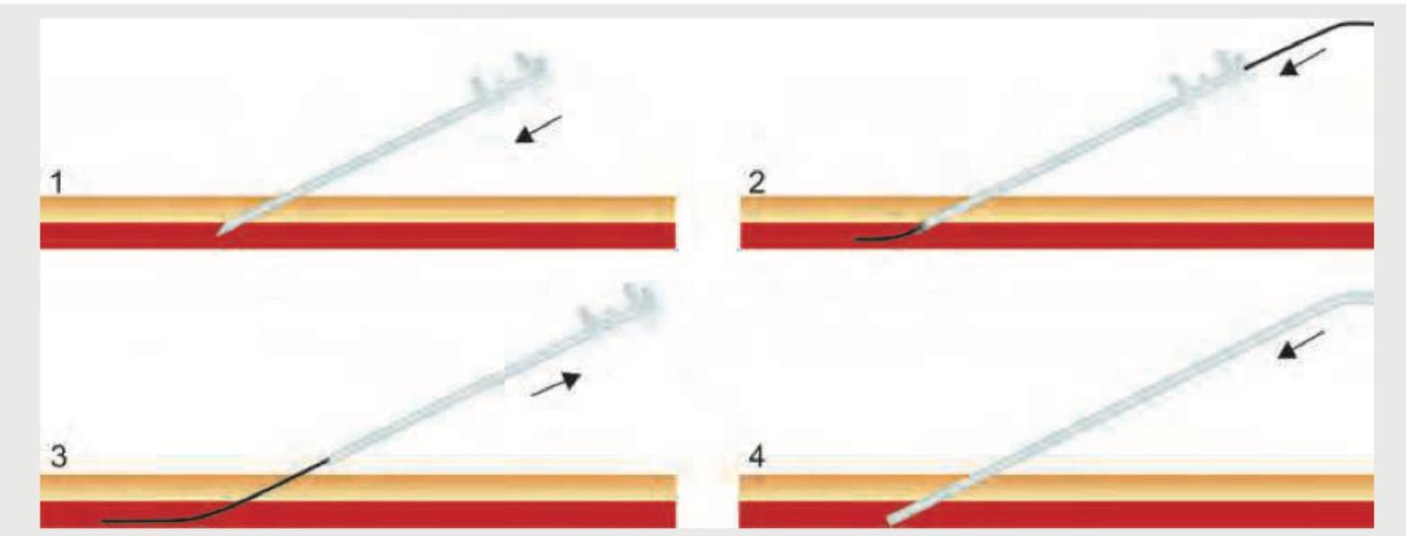 Image for question 165