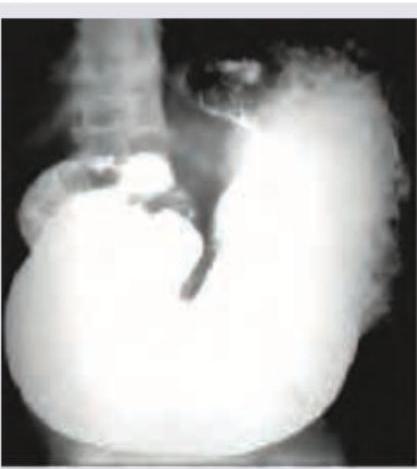 Image for question 168