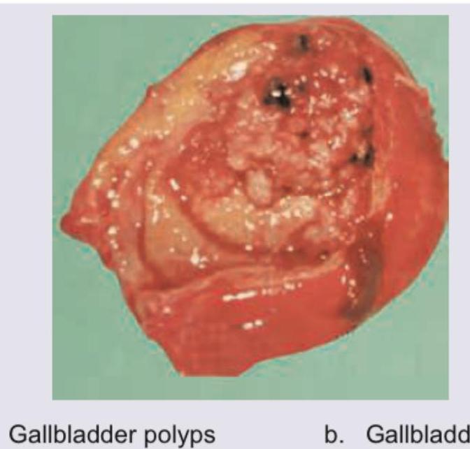 Image for question 345