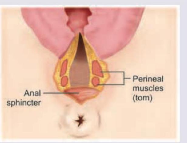 Image for question 12