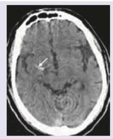 Image for question 9