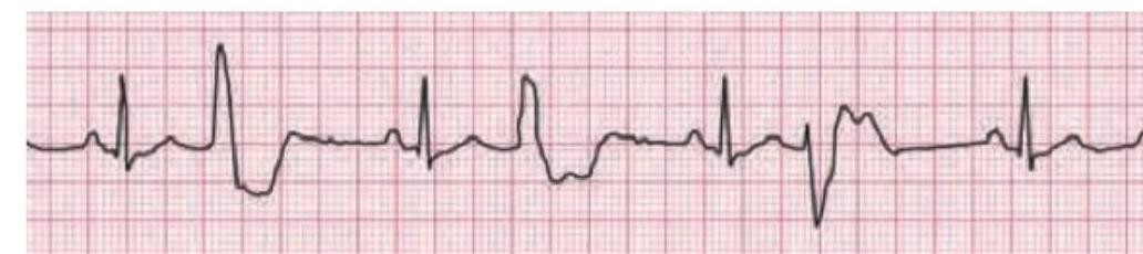 Image for question 177