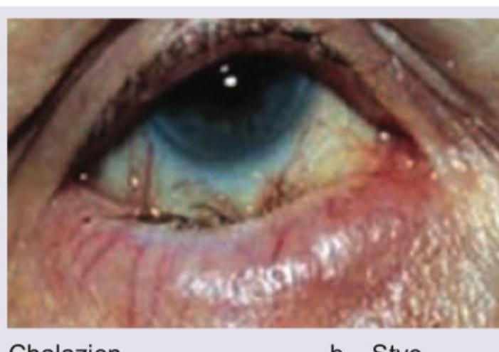 Image for question 37