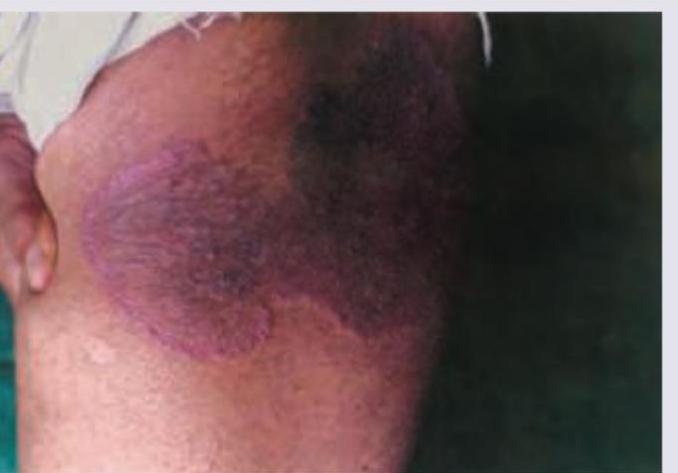 Image for question 109