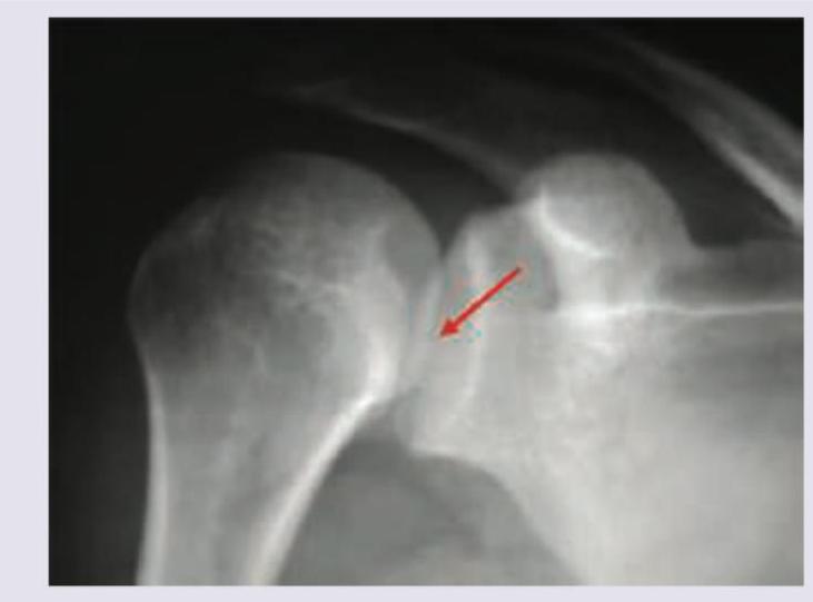 Image for question 914