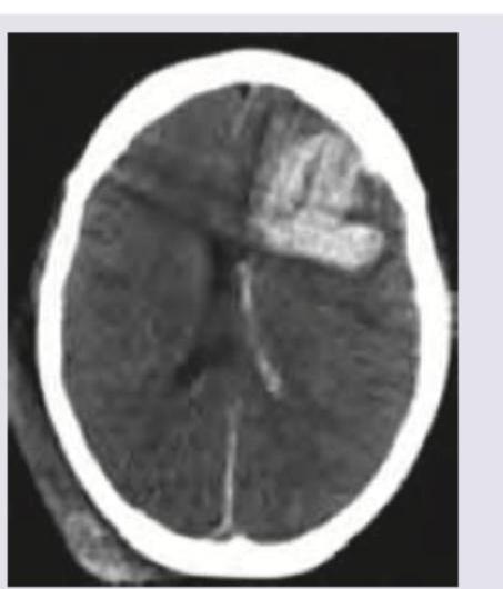 Image for question 348