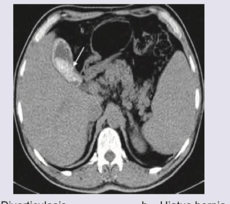 Image for question 546