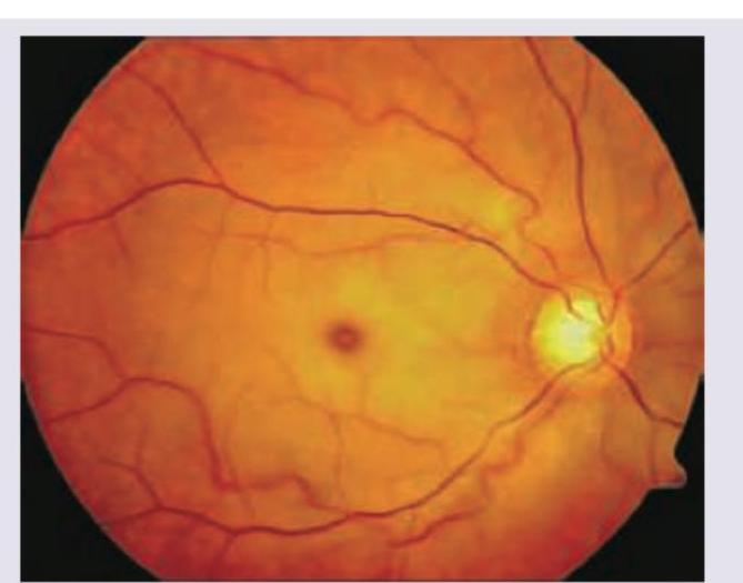 Image for question 460