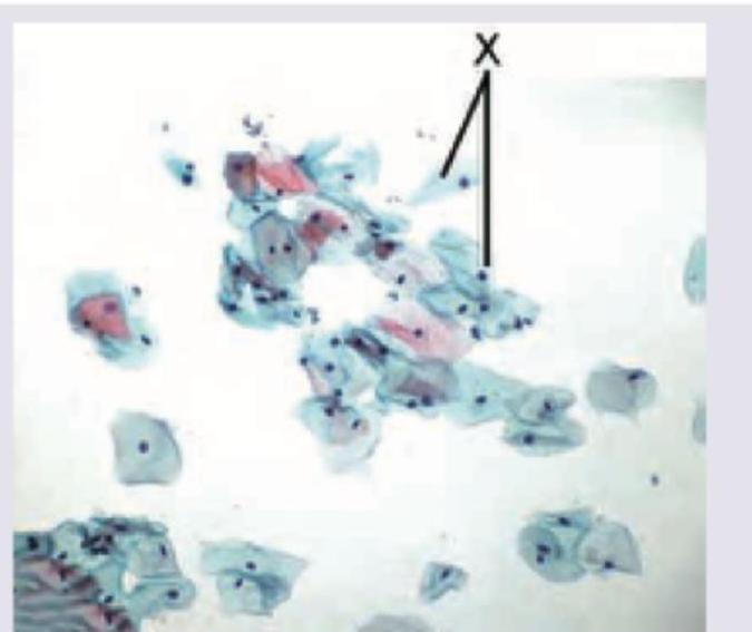 Image for question 922