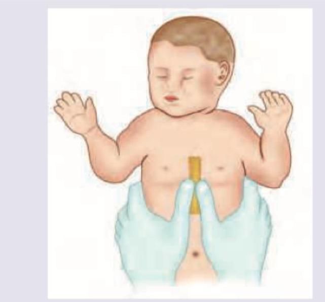 Image for question 722