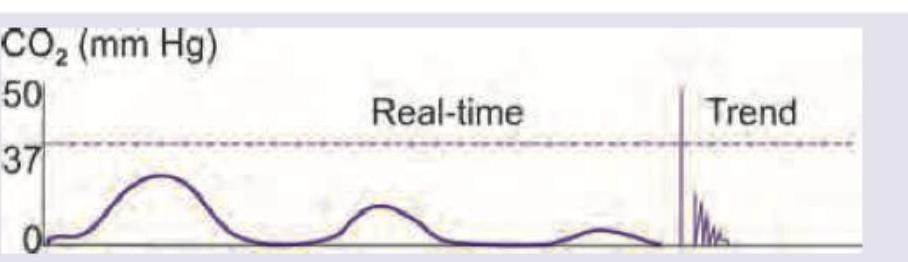 Image for question 291