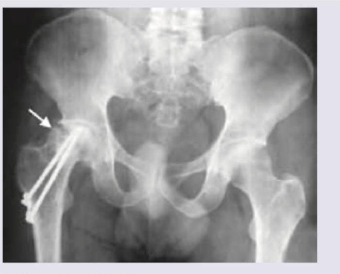 Image for question 905