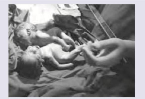 Image for question 929