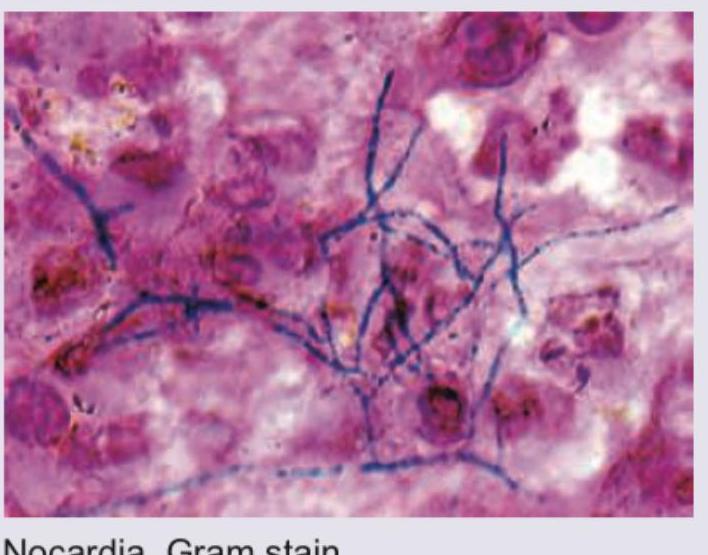 Image for question 70