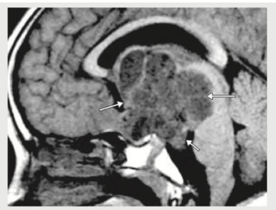 Image for question 352