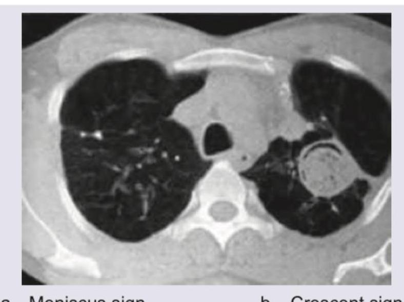 Image for question 357