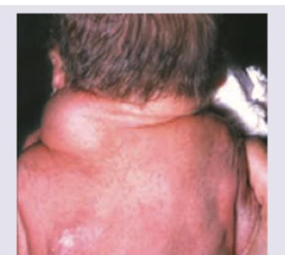 Image for question 126