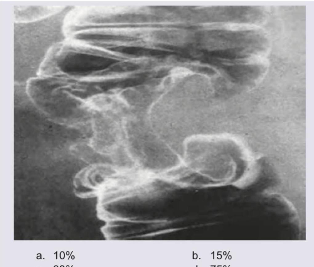 Image for question 249