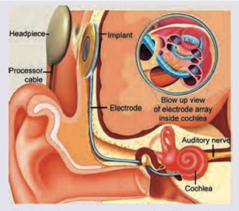 Image for question 308