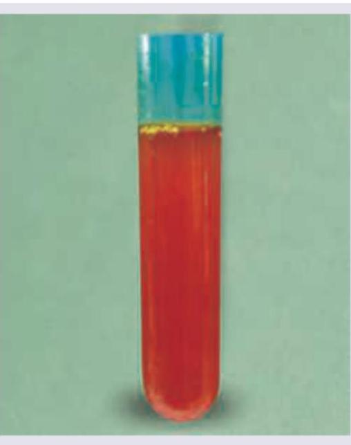 Image for question 241