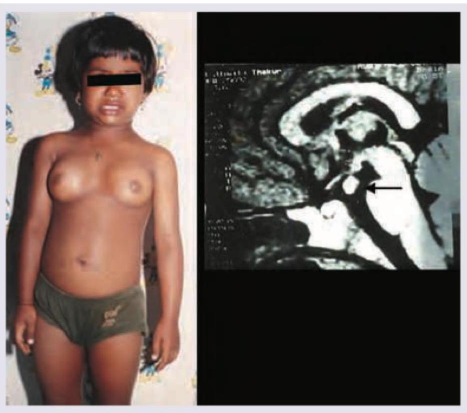 Image for question 341