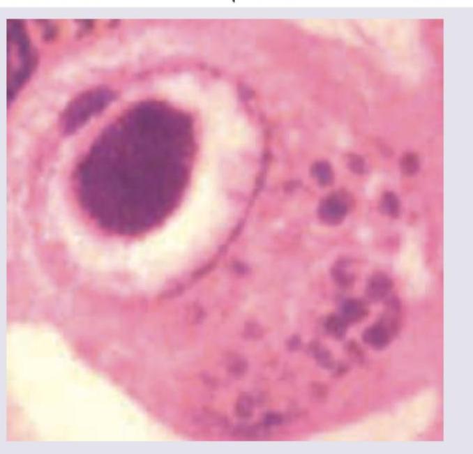 Image for question 357