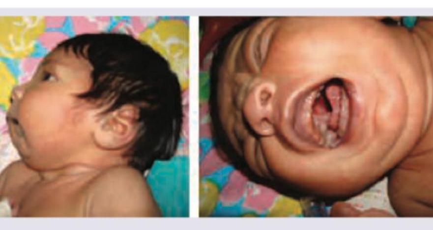 Image for question 997