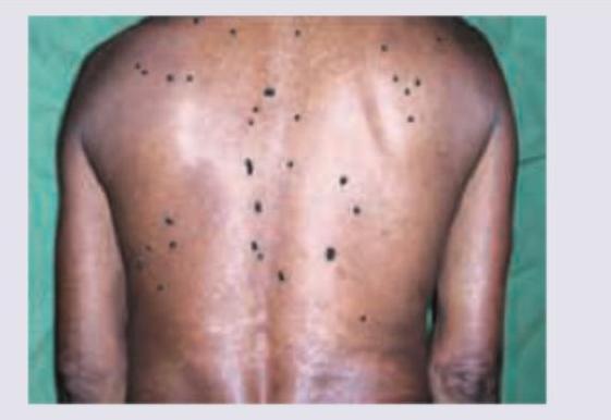 Image for question 781