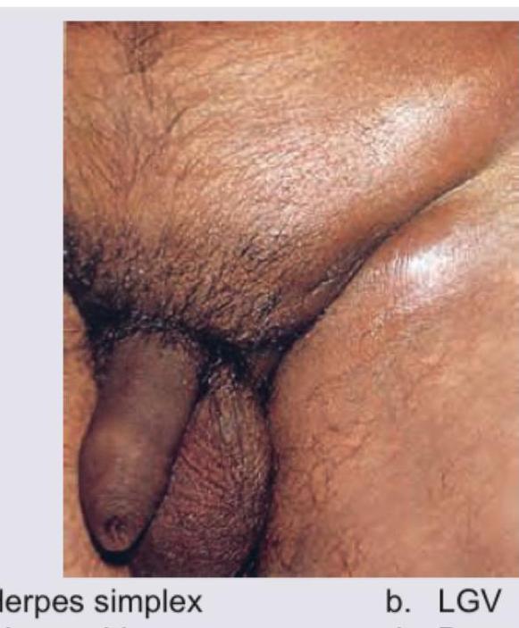 Image for question 170