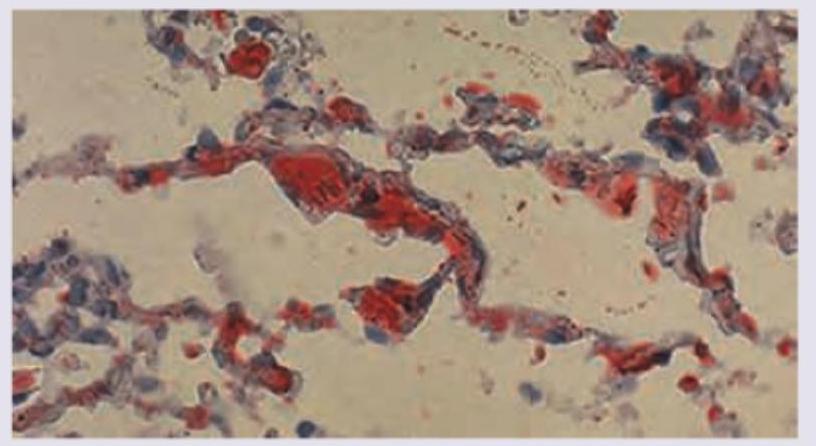 Image for question 411